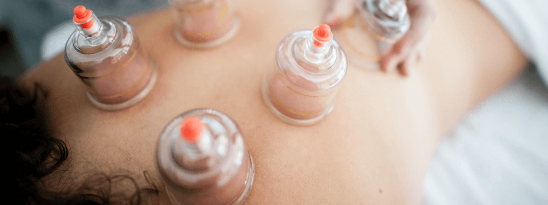 What are the benefits of Dry Cupping Therapy?